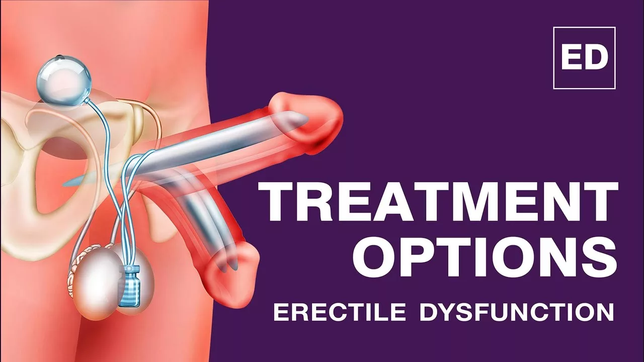 Treatment Options for Erectile Dysfunction (ED)